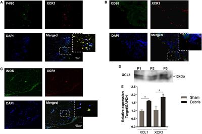 Blockade of XCL1/Lymphotactin Ameliorates Severity of Periprosthetic Osteolysis Triggered by Polyethylene-Particles